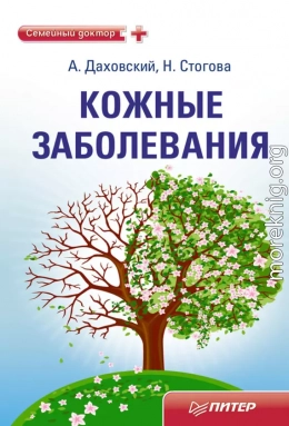 Кожные заболевания