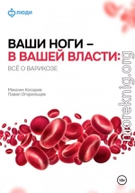 Ваши ноги – в вашей власти: всё о варикозе